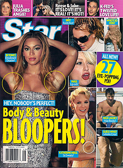 Illustration for article titled This Week In Tabloids: Twisted Childhoods, Plastic Surgery Addictions & Body Bloopers